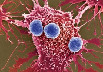 bacteria cancer research