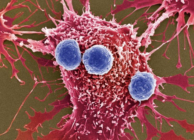 bacteria cancer research